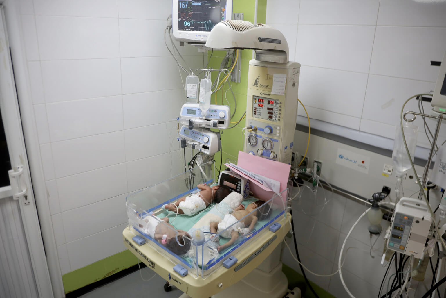 Paediatric intensive care unit